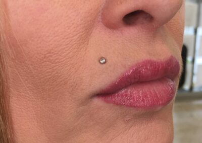 Maquillage permanent : remplissage lèvres