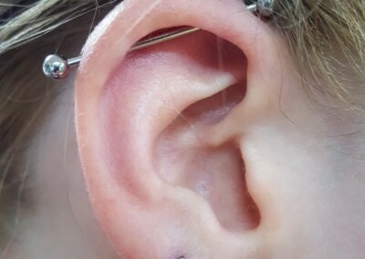 oreille industriel et lobe X3