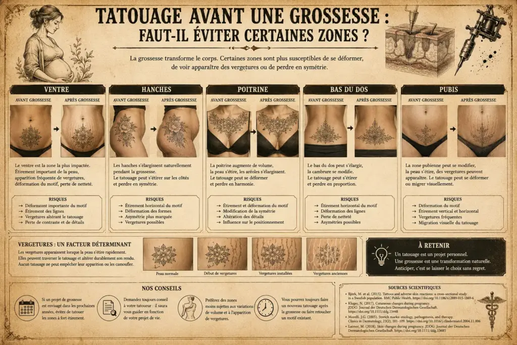 Infographie montrant l'évolution possible d'un tatouage sur le ventre, les hanches, la poitrine, le bas du dos et le pubis avant et après une grossesse.